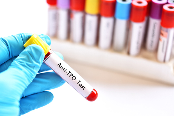 diagnosis hashimoto thyroiditis