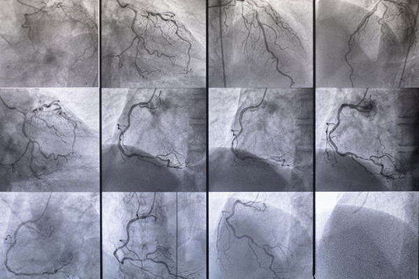 coronary artery examination