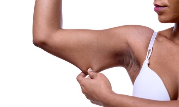 How to lose weight and keep your skin intact