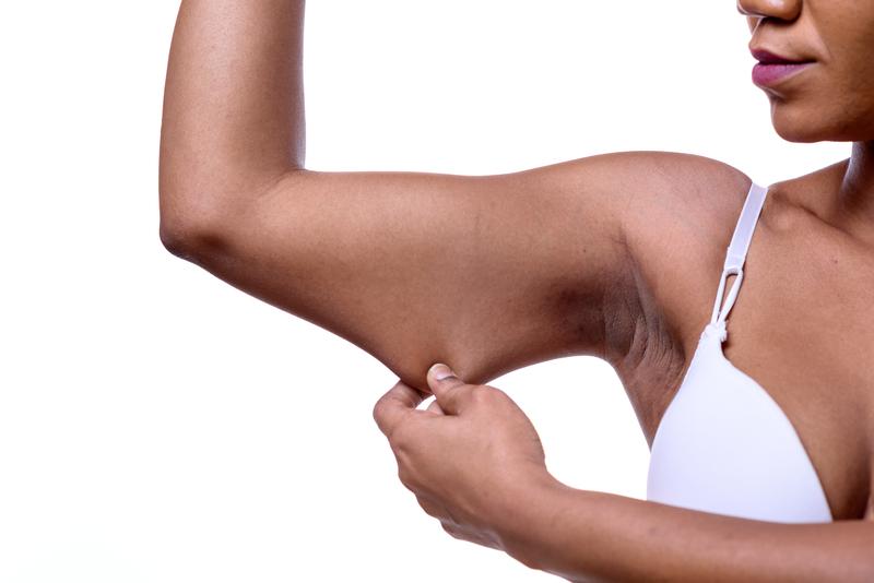How to lose weight and keep your skin intact