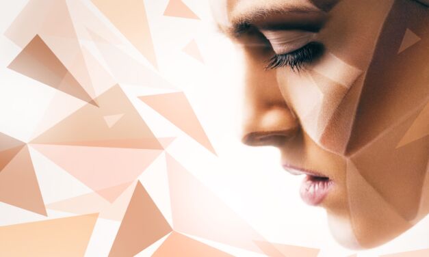 Everything you need to know about hyperpigmentation