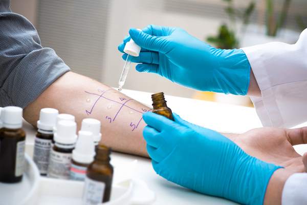 Prick test