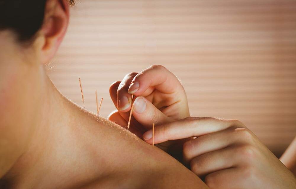 Acupuncture and its benefits: is it an effective method?