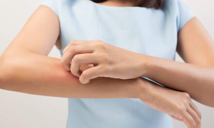 types, symptoms and treatments recommended InSalute