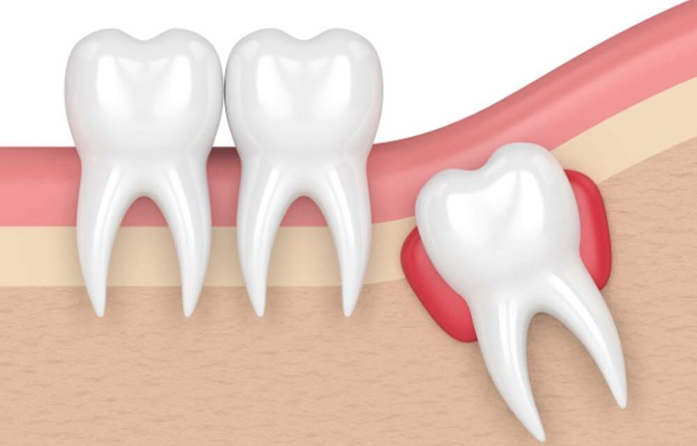 the most frequent causes and InSalute therapies