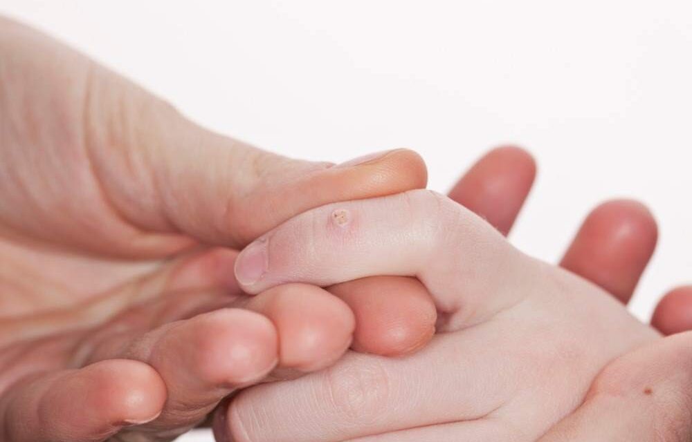 how to treat them and how to avoid InSalute infection