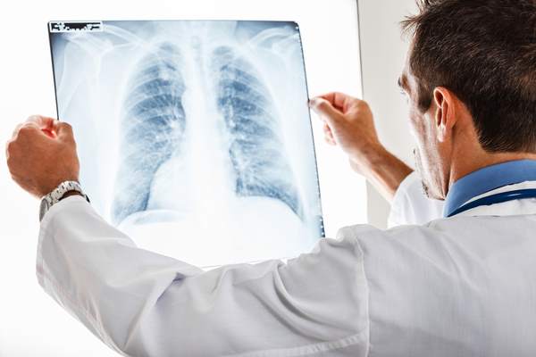daignosis viral pneumonia