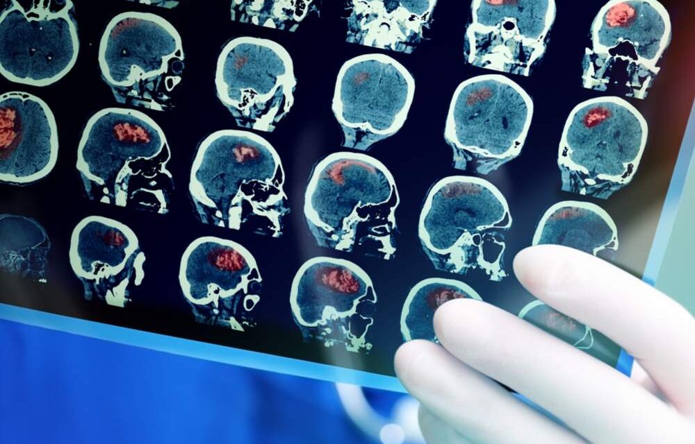 the causes, risk factors and InSalute prevention practices