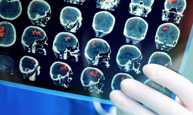 the causes, risk factors and InSalute prevention practices