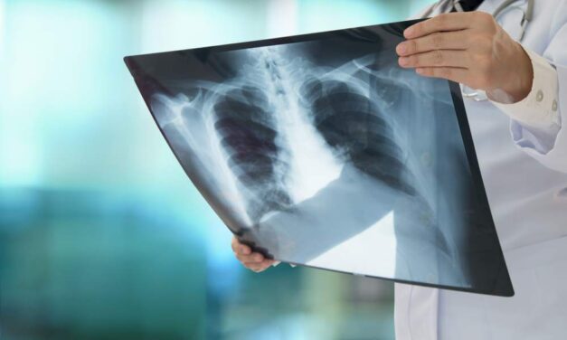 the causes, diagnosis, therapy and prevention InSalute